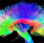 Họa sĩ có cấu trúc não bộ khác với người thường