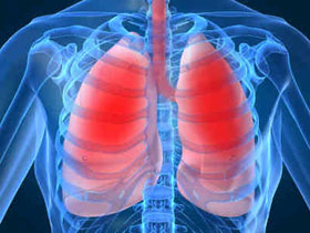 Hơn 1 triệu trẻ em chết do viêm phổi mỗi năm