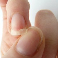 Móng tay dễ gãy: 6 nguyên nhân thường gặp và cách khắc phục nhanh chóng
