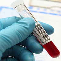 Mono trong xét nghiệm máu là gì?
