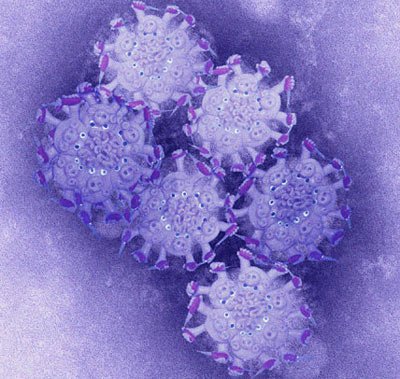 Nam thanh niên 30 tuổi chết vì H1N1