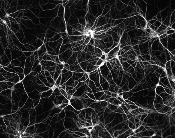 Não người đã bị đi giảm tới 14 tỷ tế bào thần kinh