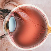 Nguyên nhân gây đau hốc mắt và thời điểm cần gặp bác sĩ