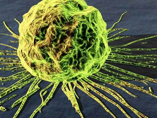 Nhật phát hiện loại gen đẩy nhanh di căn ung thư
