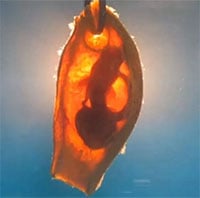 Những hình ảnh thú vị về bào thai cá mập tre vằn