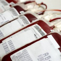 Những lưu ý cần biết khi hiến máu