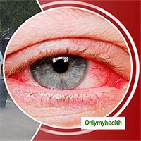 Ô nhiễm do khói xe: Nguyên nhân hàng đầu gây các bệnh về mắt