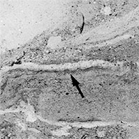 Phát hiện hoá thạch giun 500 triệu năm tuổi dưới đáy biển cổ đại