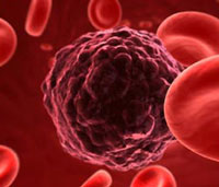 Phát hiện mới về gen liên quan bệnh ung thư máu