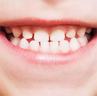 Phát triển loại thuốc giúp răng mọc lại nhiều lần