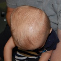 Thóp đầu của trẻ sơ sinh: những điều mẹ nên biết!