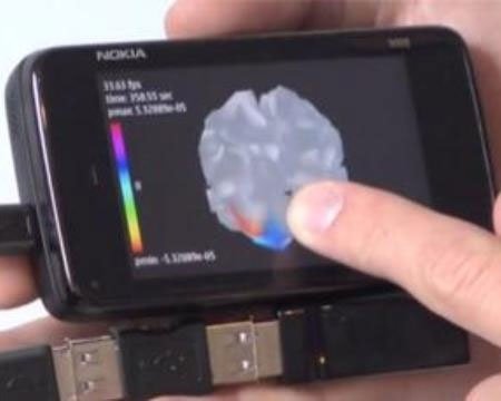 Ứng dụng của Nokia có khả năng quét não di động