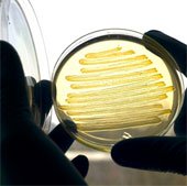 Vi khuẩn E.coli có thể sản xuất diezel