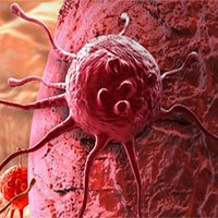 Vì sao tế bào ung thư lan nhanh bất thường?