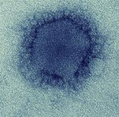 Virus gây bệnh MERS từng lây từ động vật sang người