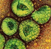 Virus MERS-CoV ít có khả năng lây lan thành dịch